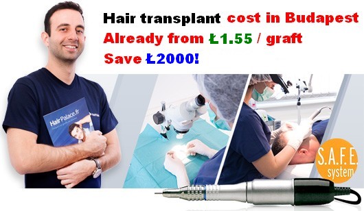 Real price of hair restoration abroad - UK, Turkey, Hungary